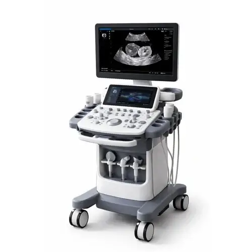 Ultrasound diagnostic system